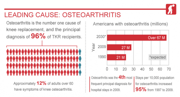 osteoarthritis and golf